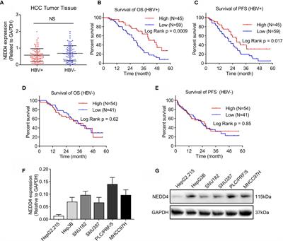 NEDD4 Induces K48-Linked Degradative Ubiquitination of Hepatitis B Virus X Protein and Inhibits HBV-Associated HCC Progression